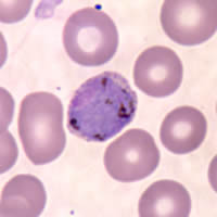 P. vivax gametocyte - thin smear
