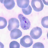 P. vivax ring - thin smear