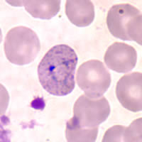 P. vivax ring - thin smear