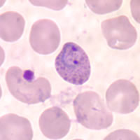P. vivax ring - thin smear