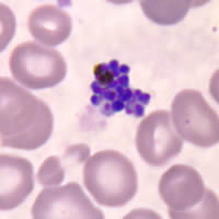 P. vivax schizont - thin smear