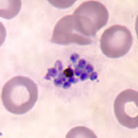 P. vivax schizont - thin smear