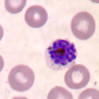 P. vivax schizont - thin smear