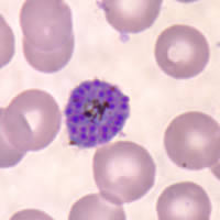 P. vivax schizont - thin smear
