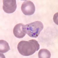 P. vivax trophozoite - thin smear