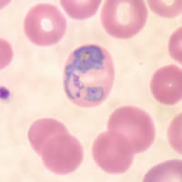 P. vivax trophozoite - thin smear
