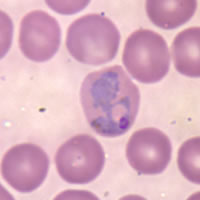 P. vivax trophozoite - thin smear