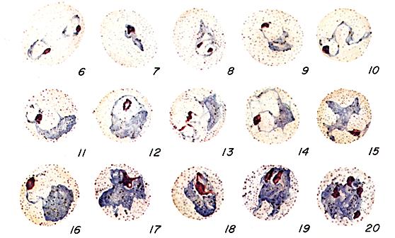 P. vivax trophozoites