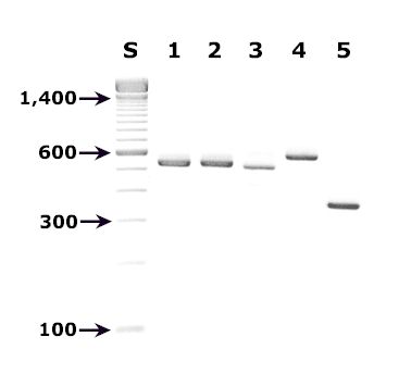 Agarose gel - PCR for microsporidia