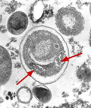 Enterocytozoon bieneusi spore