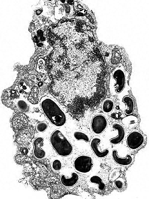 Eukaryotic cell with E. intestinalis spores