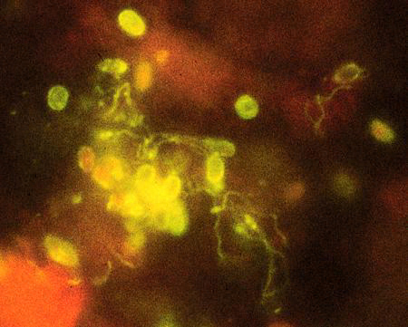 Monoclonal antibody-based immunofluorescence identification of Encephalitozoon hellem