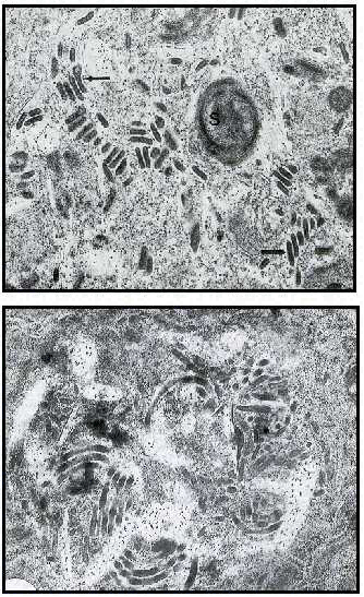 Intracellular stages