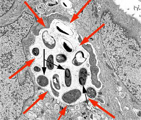 E. intestinalis, developing forms in a parasitophorous vacuole