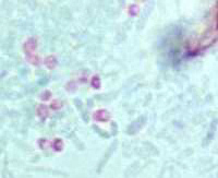 Microsporidian spores stained with Chromotrope 2R stain