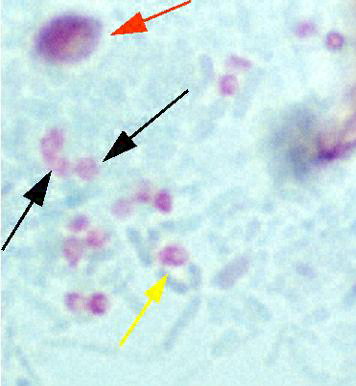 Spores stained with Chromotrope 2R