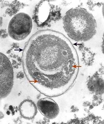 Microsporidian spore