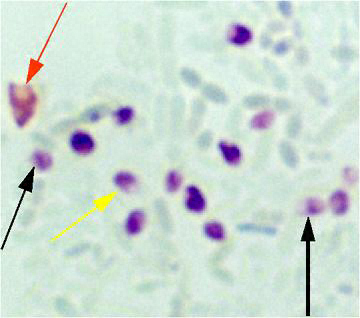 Spores stained with Quick-Hot Gram Chromotrope