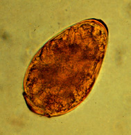Paragonimus westermani egg
