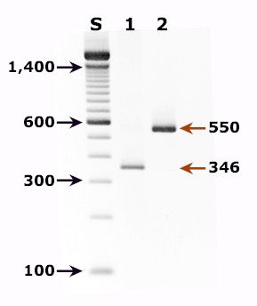 Agarose Gel - PCR for Pneumocystis