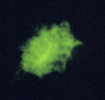Pneumocystis jiroveci 