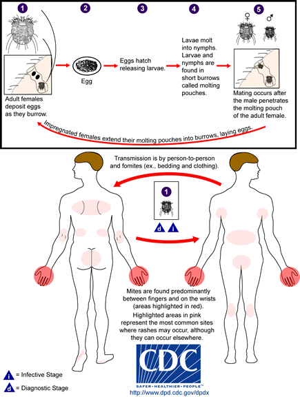 Life cycle of Sarcoptes scabei