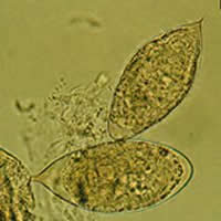 S. haematobium eggs