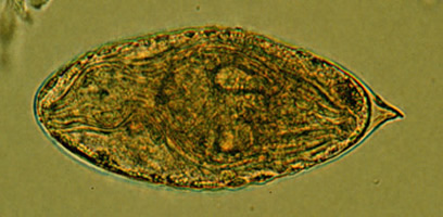 S.haematobium egg