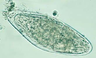 S. haematobium egg