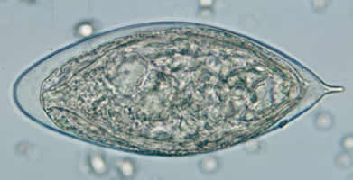 S. haematobium egg