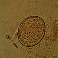 S. japonicum egg