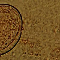 S. japonicum egg