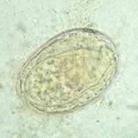 S. japonicum egg