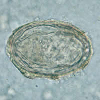 S. japonicum egg
