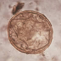 S. japonicum egg