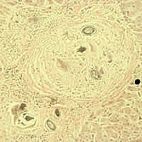 S. japonicum eggs in liver