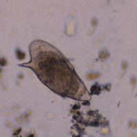 S. mansoni egg 