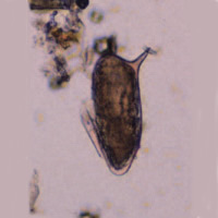 S. mansoni egg 