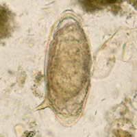 S. mansoni egg