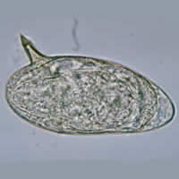 S. mansoni egg