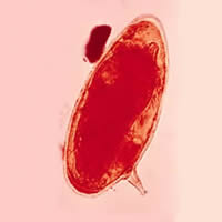 S. mansoni egg