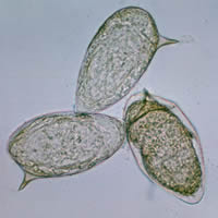 S. mansoni eggs