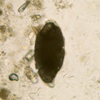 S. mansoni egg