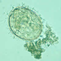 S. mekongi egg