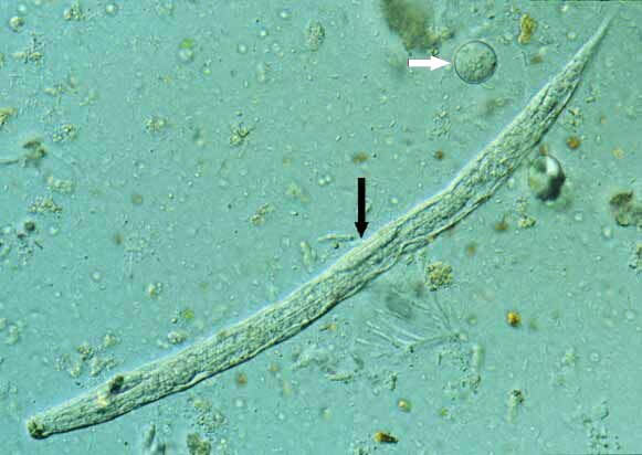 Strongloides stercoralis larva