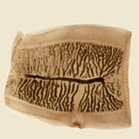 T. saginata gravid proglottid