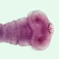 T. solium scolex