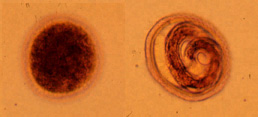 Toxocara canis eggs