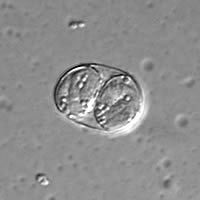 T. gondii sporulated oocyst, DIC