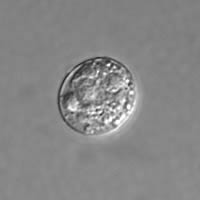 T. gondii unsporalted oocyst, DIC